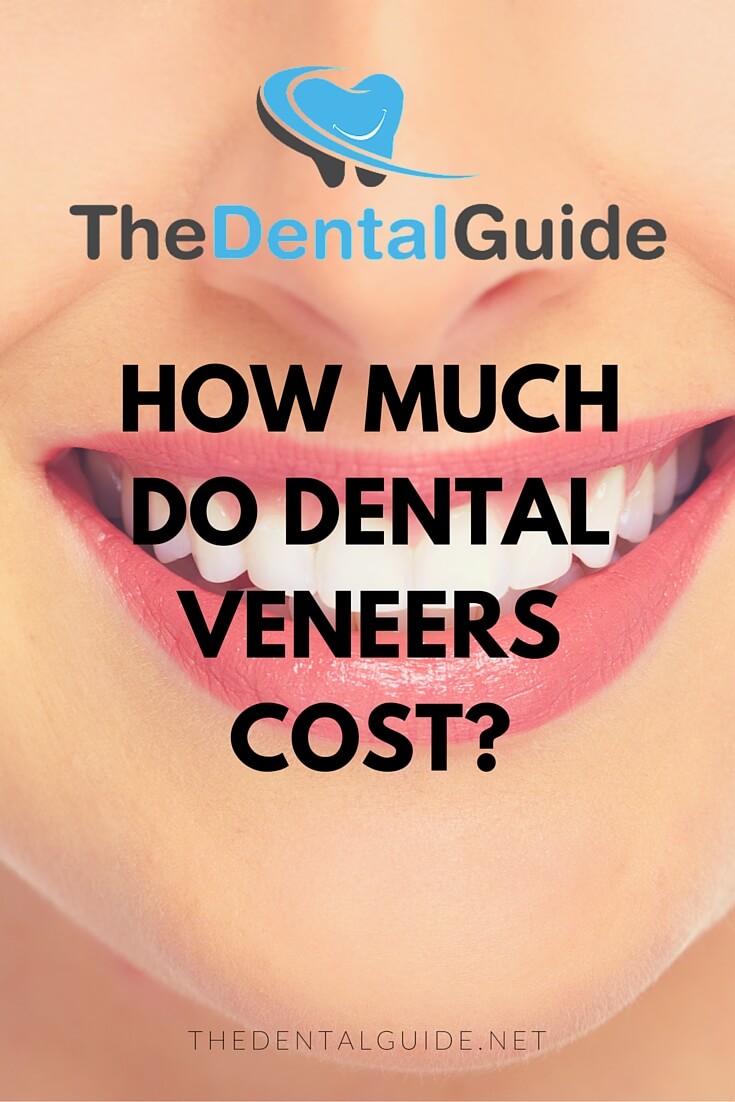 How Much Do Dental Veneers Cost In The UK? The Dental Guide