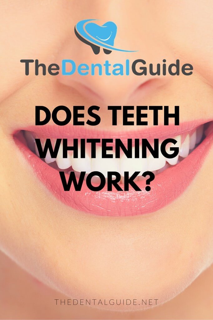 Does Teeth Whitening Work? - The Dental Guide