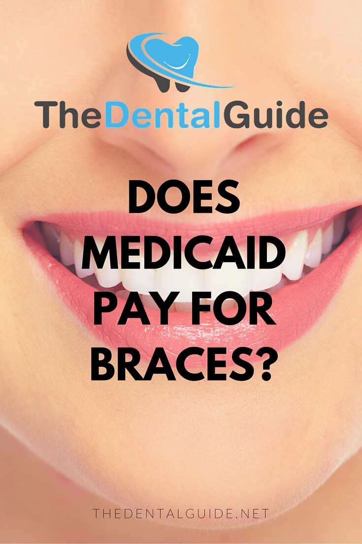 What does Medicaid for dental cover?