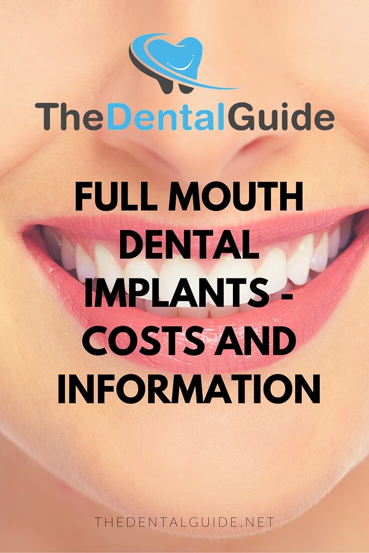 Full Mouth Dental Implants Cost 16