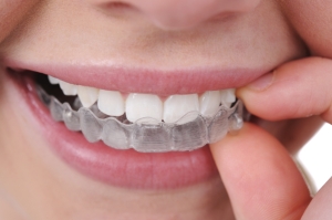 invisalign costs