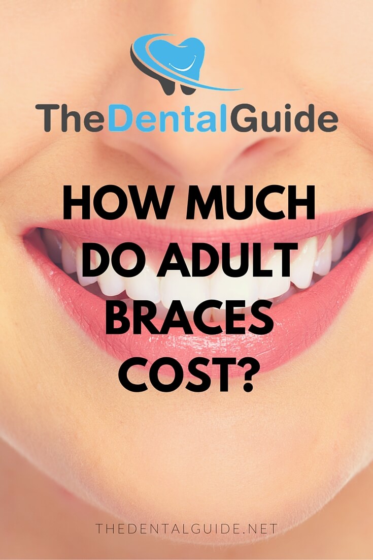 How Much Do Adult Braces Cost? The Dental Guide