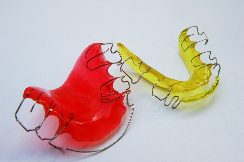 retainers for teeth