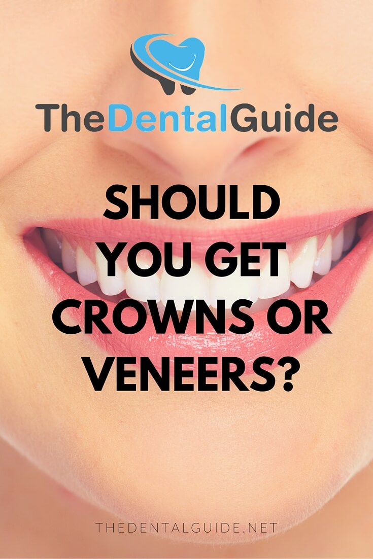 Should You Get Crowns or Veneers? The Dental Guide