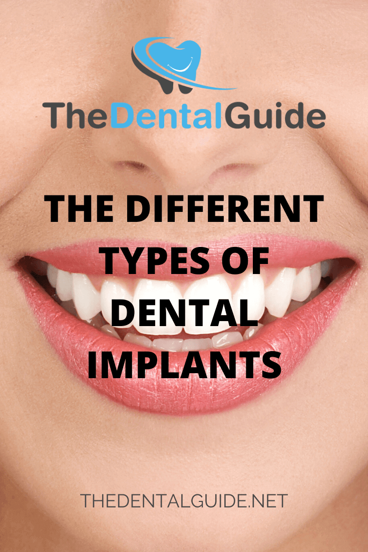 The Different Types of Dental Implants - The Dental Guide