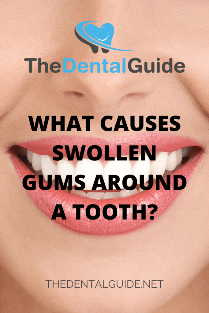 What Causes Swollen Gums Around A Tooth The Dental Guide Usa